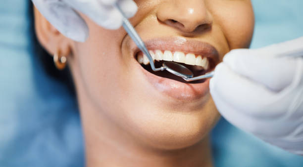 Best Pediatric Emergency Dentist in Fullerton, CA