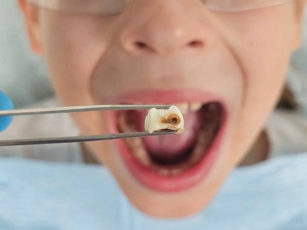 Best Mobile Emergency Dentist in Fullerton, CA